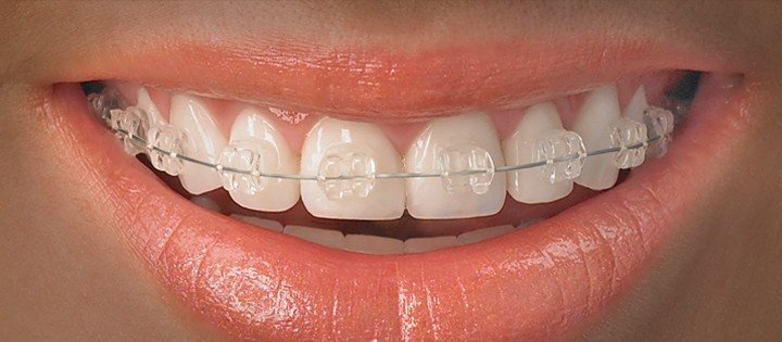 Orthodontis-cabinet stomatologie