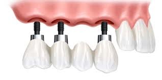 Orthodontis-cabinet stomatologie